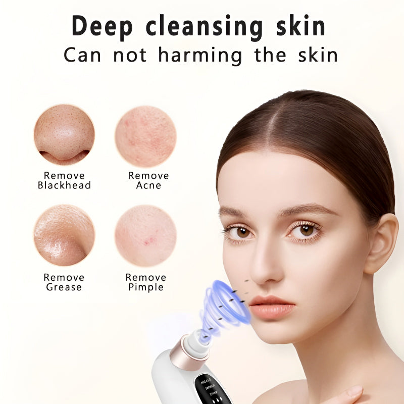 Rechargeable Blackhead Remover/ Vacuum Cleaner