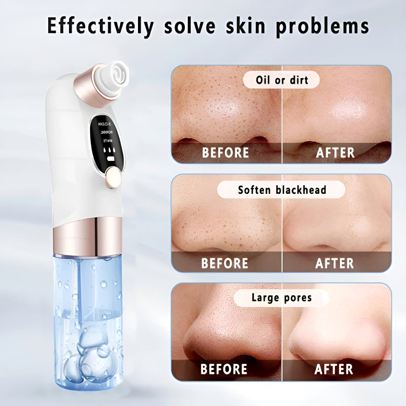 Rechargeable Blackhead Remover/ Vacuum Cleaner
