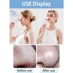 Rechargeable Blackhead Remover/ Vacuum Cleaner