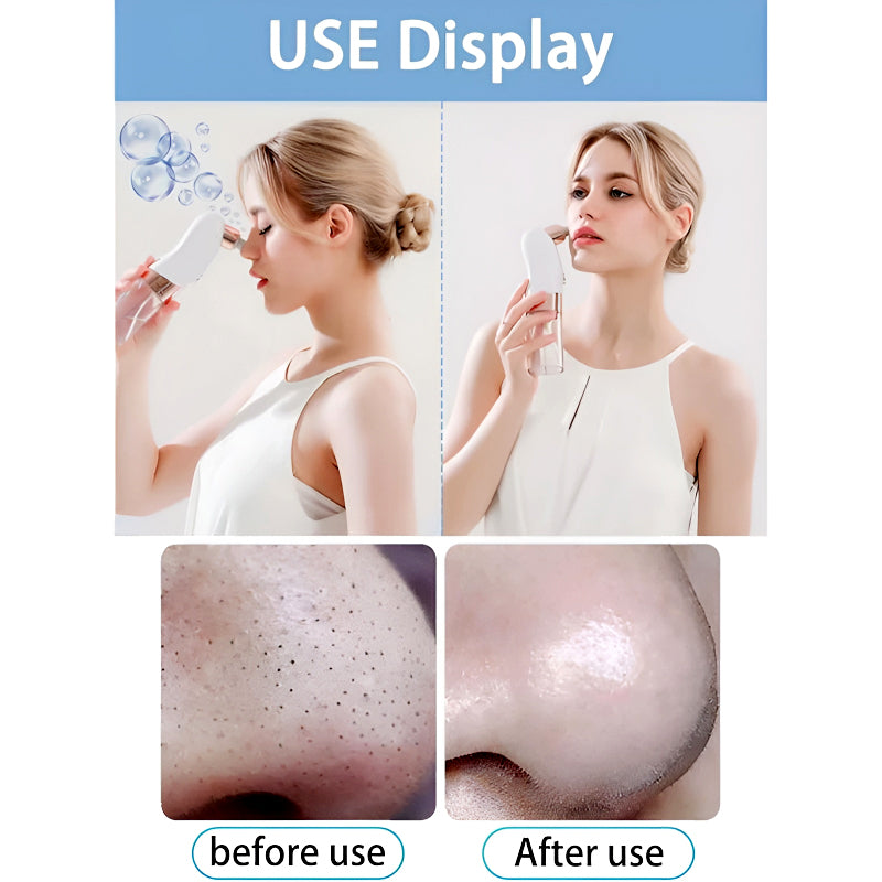 Rechargeable Blackhead Remover/ Vacuum Cleaner