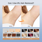 Babyverse SE12 IPL Hair Removal