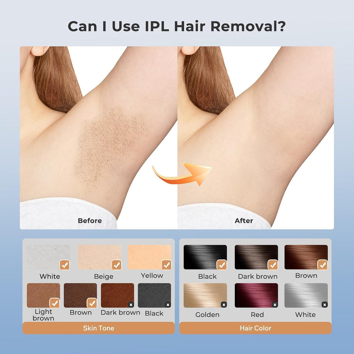 Babyverse SE12 IPL Hair Removal