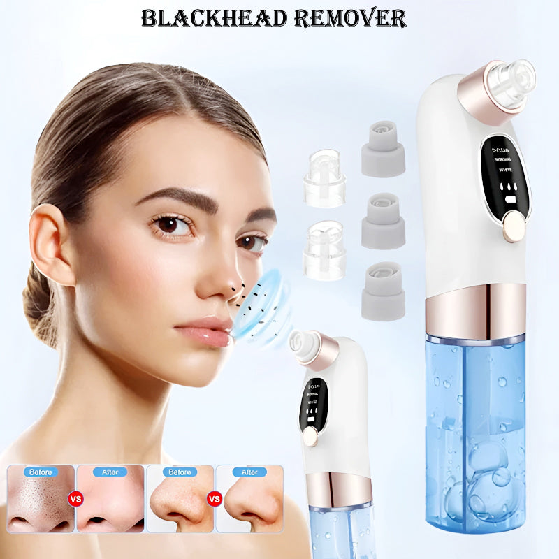 Rechargeable Blackhead Remover/ Vacuum Cleaner