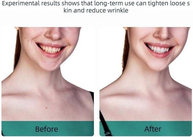 Rechargeable Anti-Wrinkle Facial Massager Device