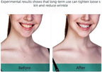 Rechargeable Anti-Wrinkle Facial Massager Device