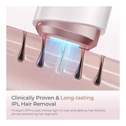 BabyVerse IPL Hair Removal Laser